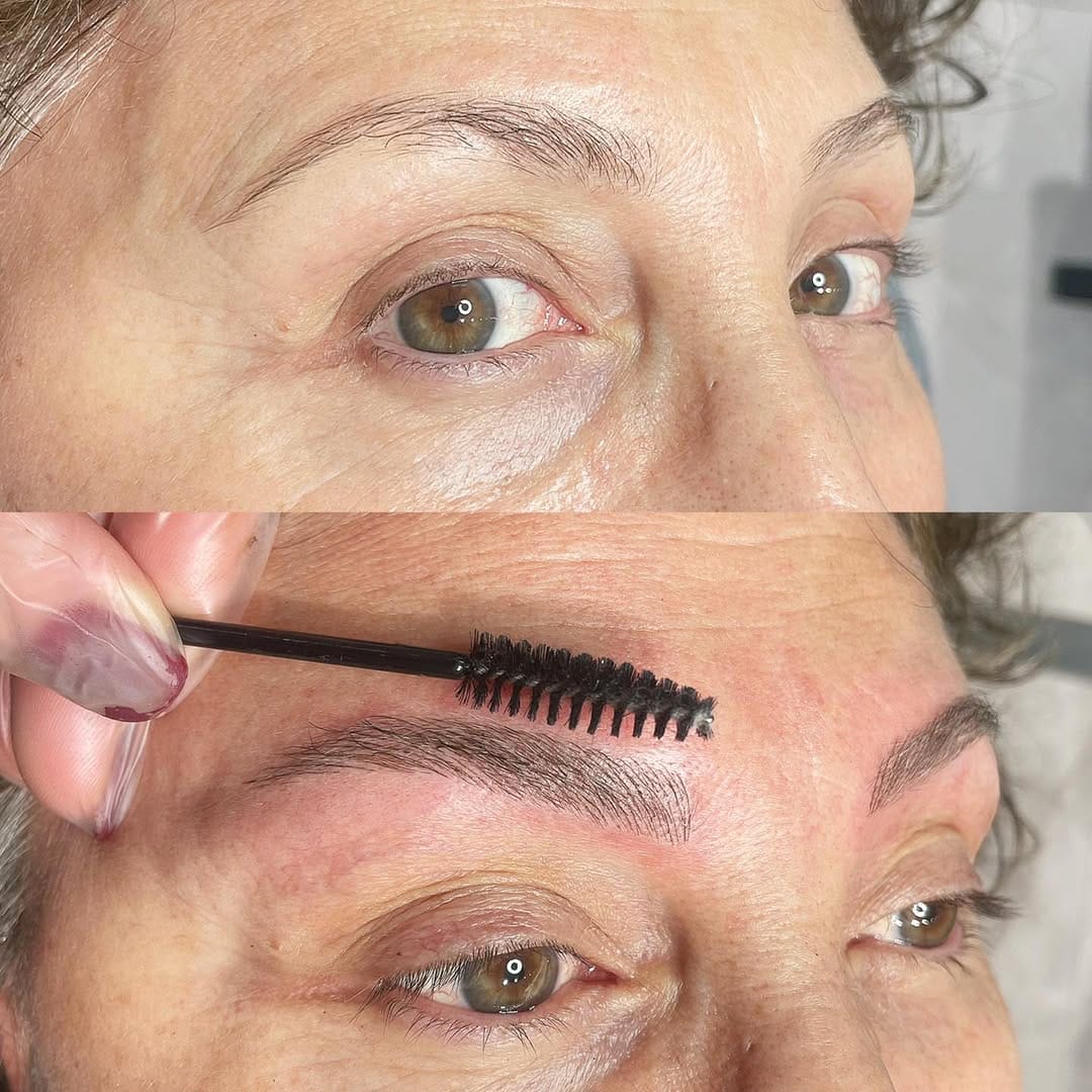 Post 9 by Bahar Kaplan Beauty Center on Instagram (image)