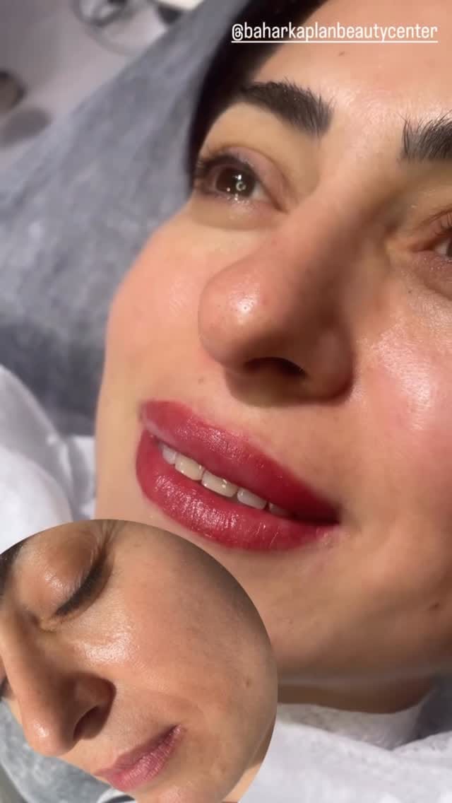 Post 4 by Bahar Kaplan Beauty Center on Instagram (video)