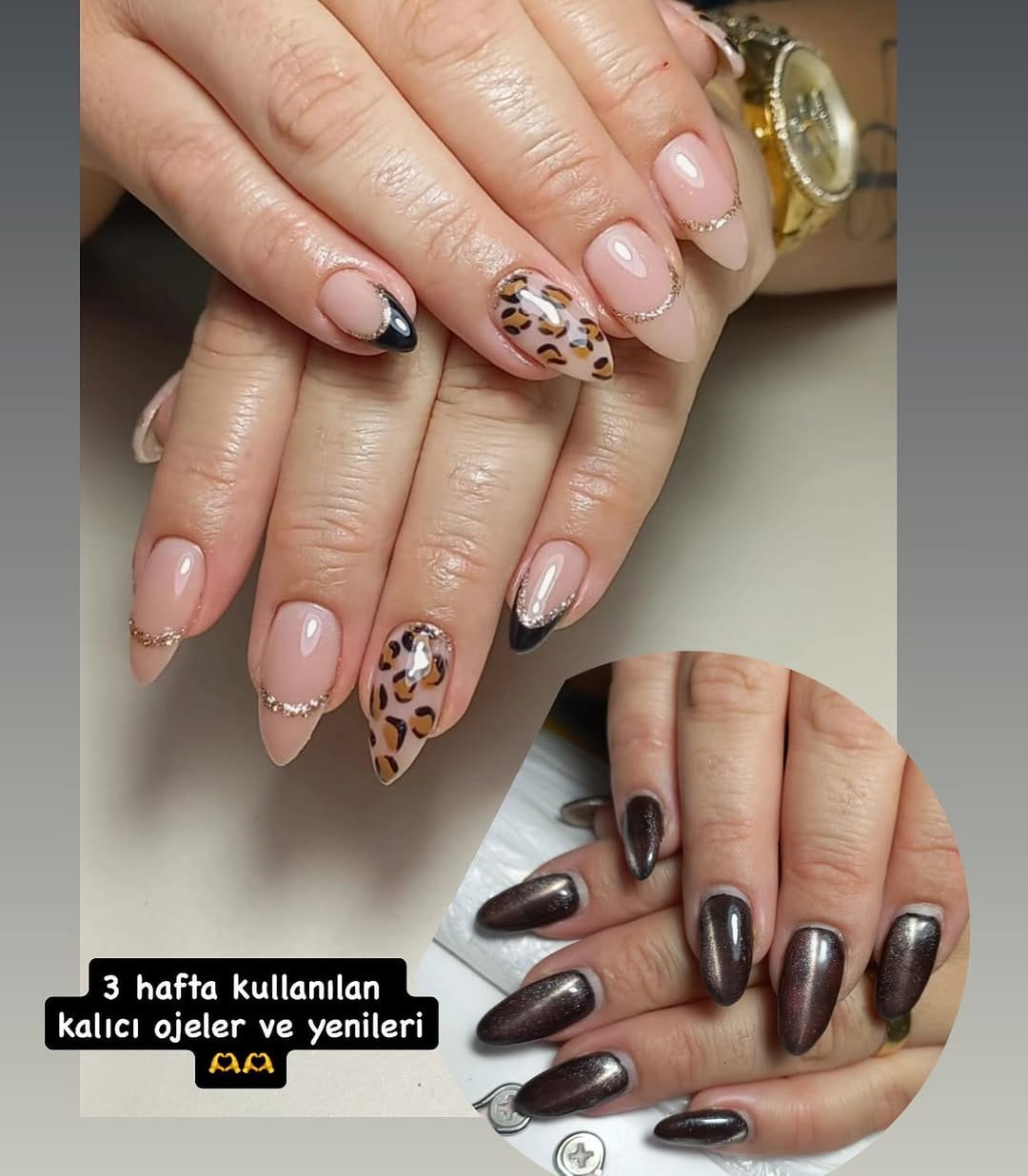 Post 5 by Bahar Kaplan Beauty Center on Instagram (image)