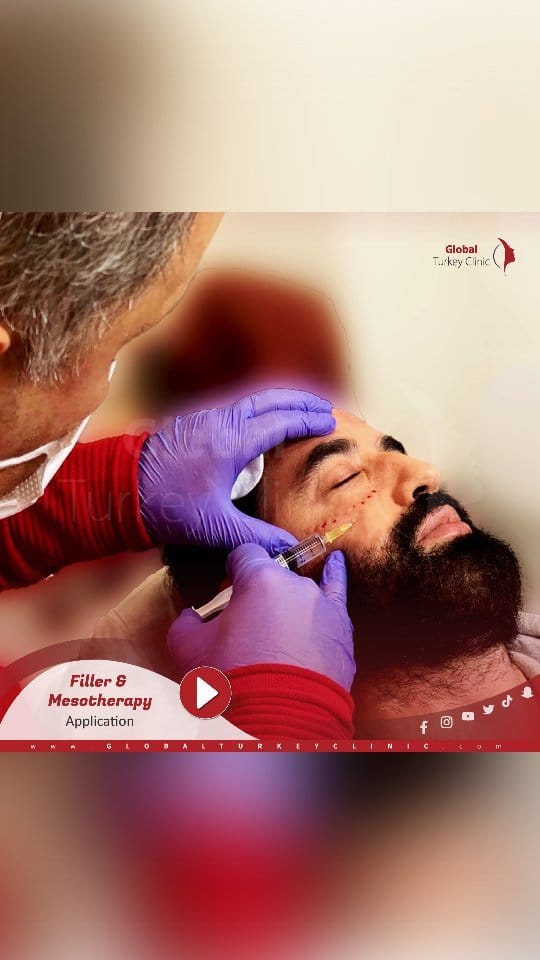 Post 7 by Global Turkey Clinic on Instagram (video)