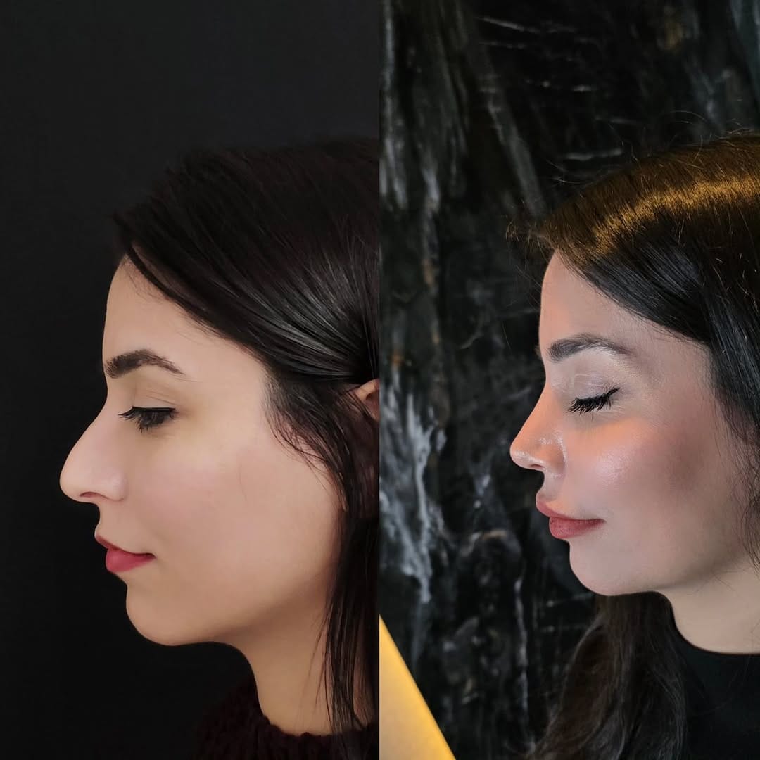 Post 3 by Op.Dr.Onur Gündoğan on Instagram (image)