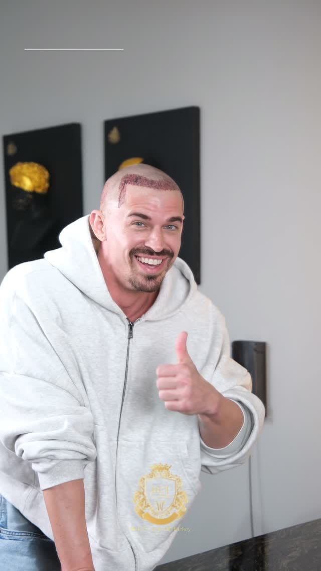 Post 2 by Hair Center Of Turkey | Hair Transplant on Instagram (video)