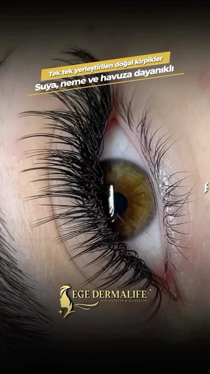 Post 6 by EGE DERMALIFE VIP BUCA on Instagram (video)