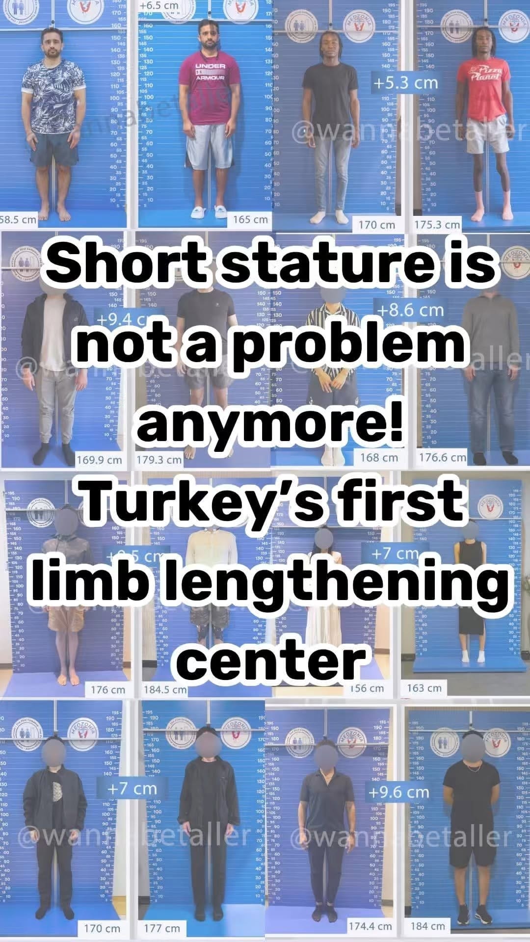 Post 10 by Limb Lengthening Surgery on Instagram (video)
