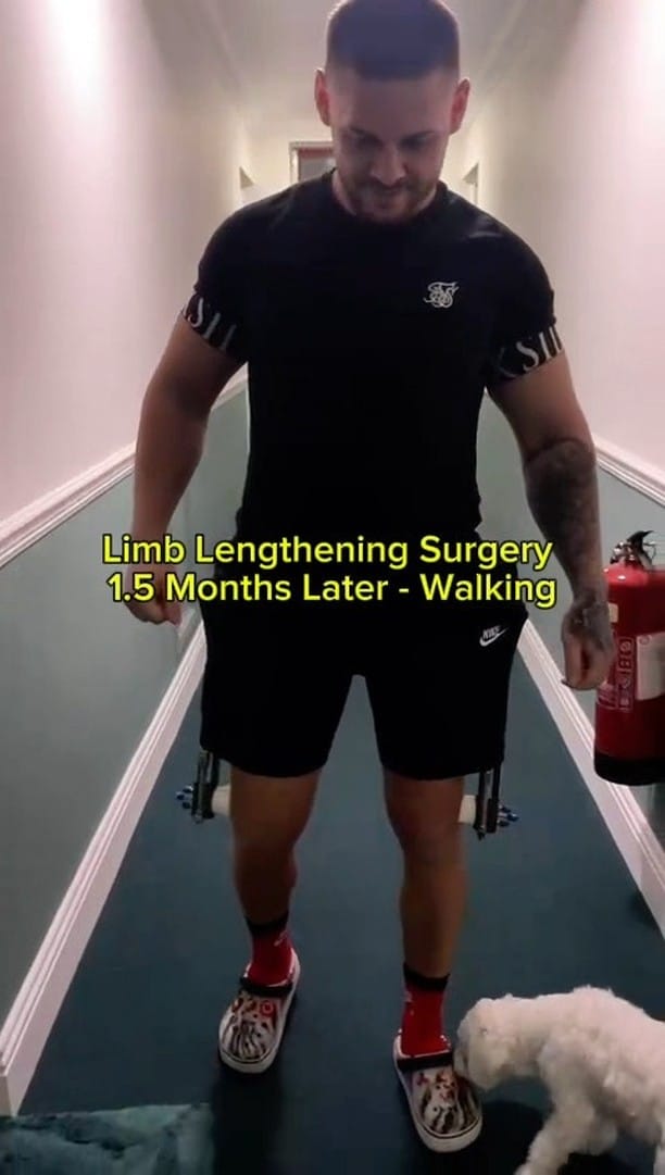 Post 9 by Limb Lengthening Surgery on Instagram (video)
