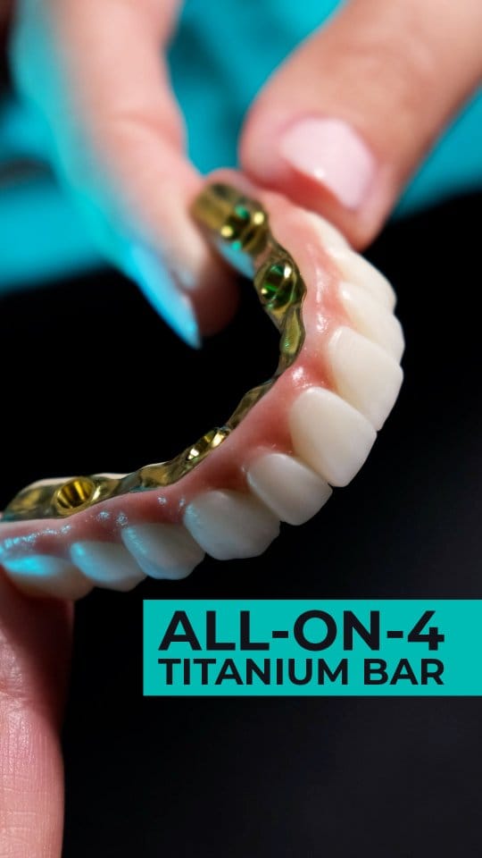 Post 2 by Antlara Dental Clinic on Instagram (video)