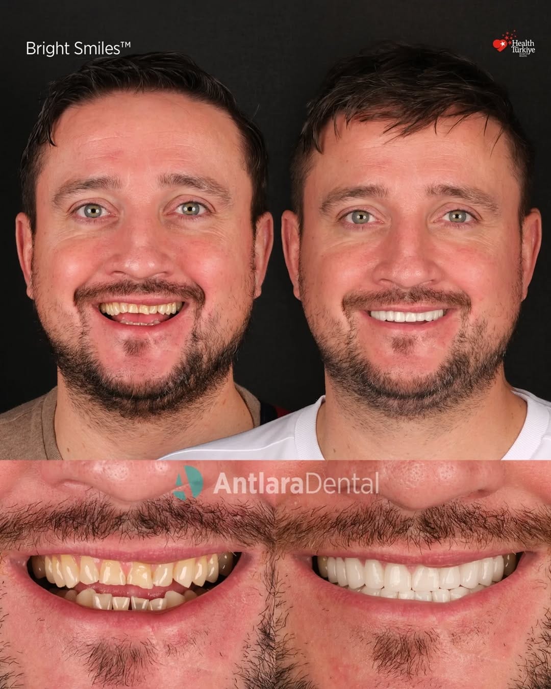 Post 4 by Antlara Dental Clinic on Instagram (carousel)