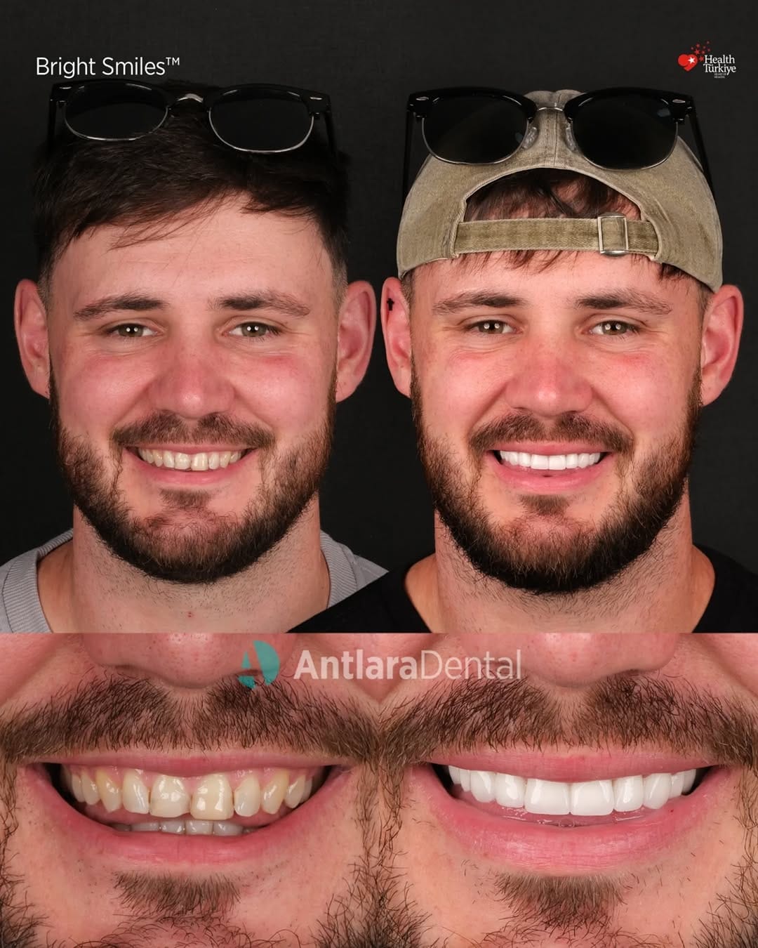 Post 10 by Antlara Dental Clinic on Instagram (carousel)