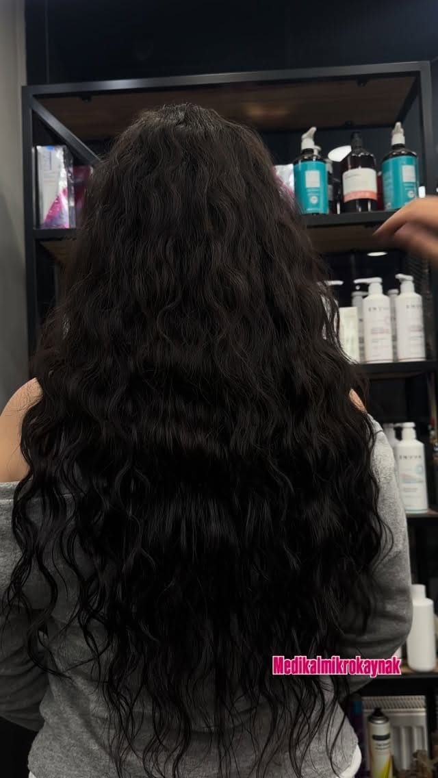 Post 5 by Mikro Kaynak Ankara Saç Kaynak on Instagram (video)