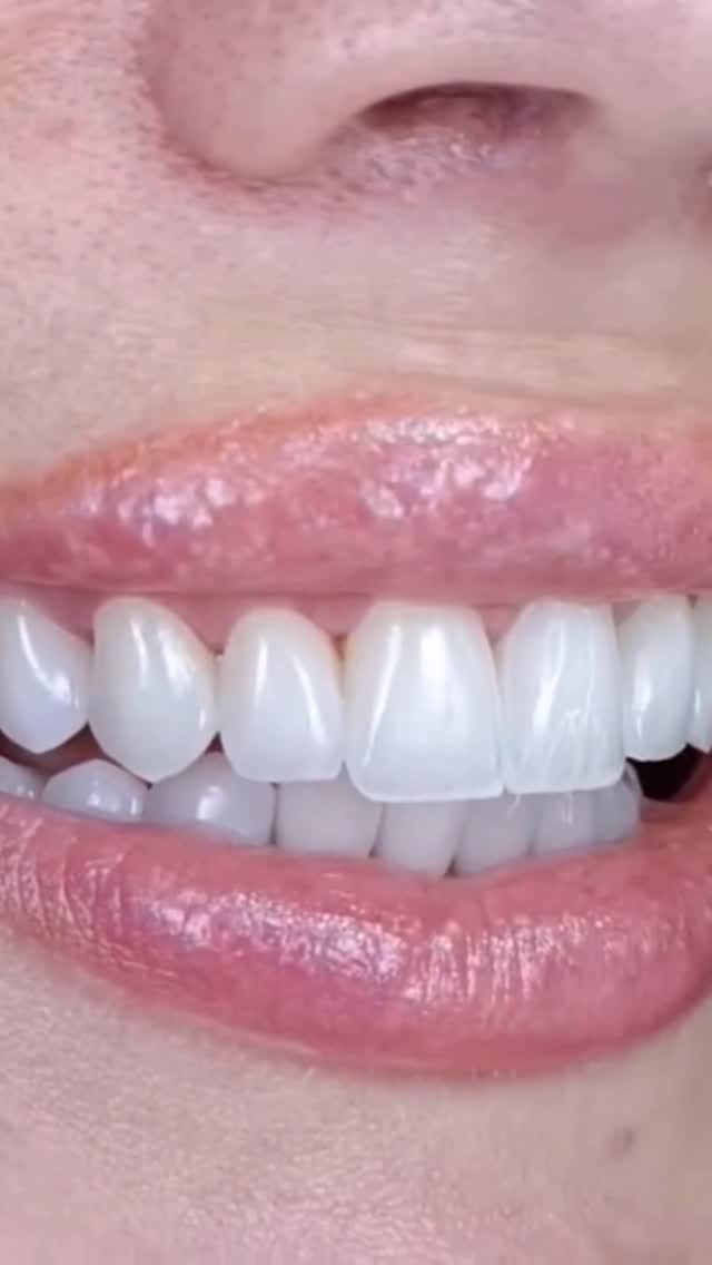 Post 1 by Natural Clinic on Instagram (video)