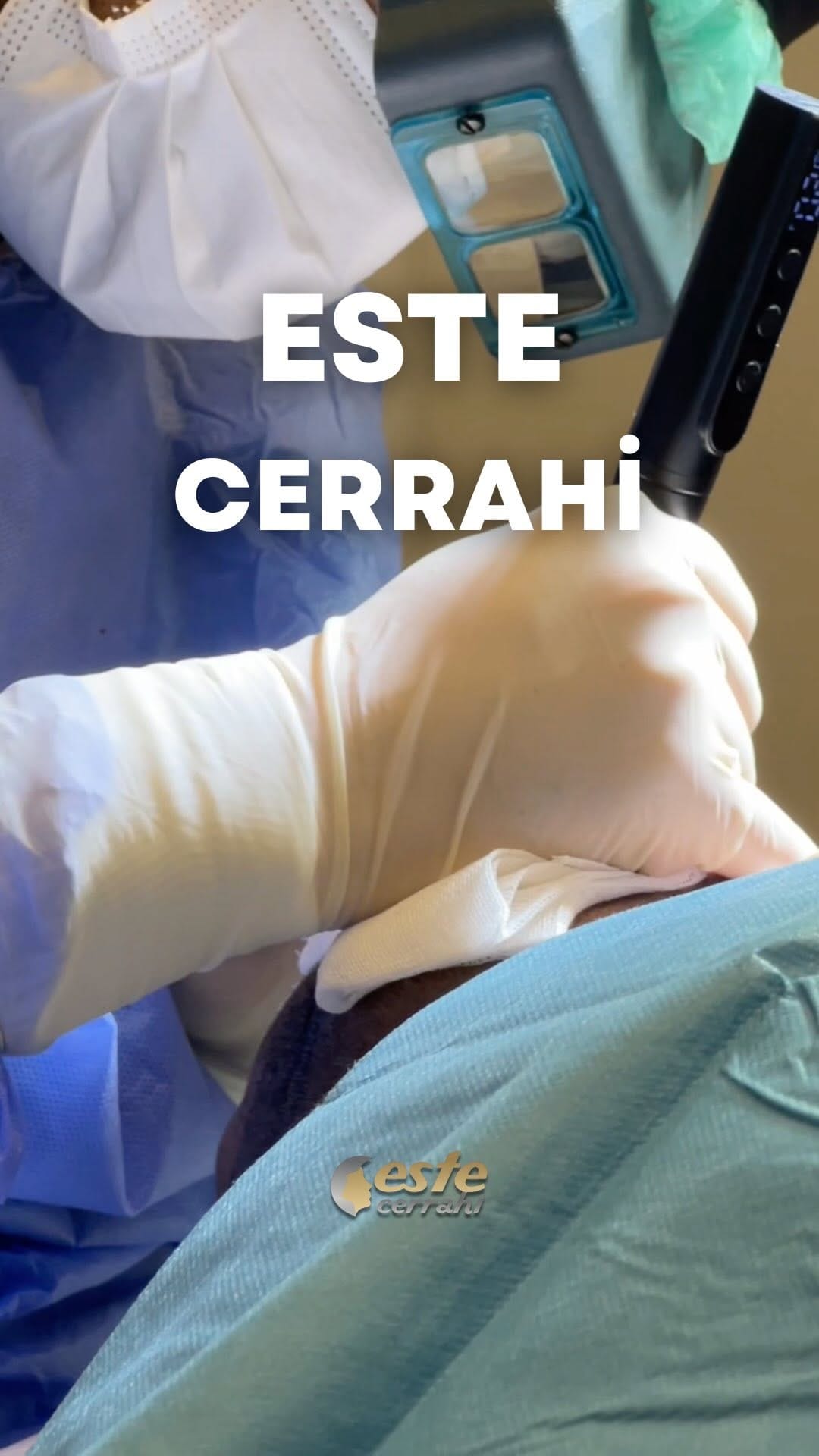 Post 1 by Este Cerrahi on Instagram (video)