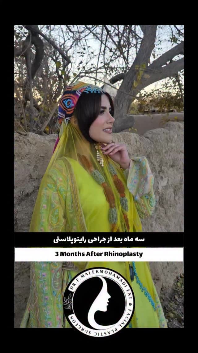 Post 5 by دکتر فریبا ملک محمدی | جراح بینی و صورت on Instagram (video)