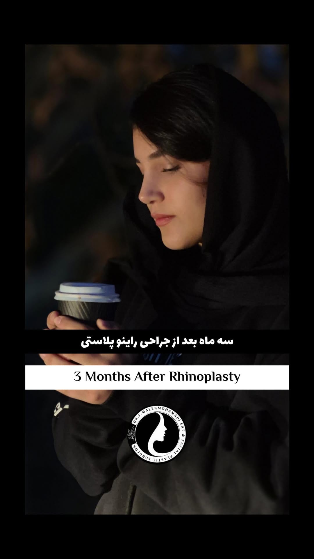 Post 7 by دکتر فریبا ملک محمدی | جراح بینی و صورت on Instagram (video)