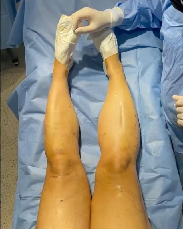 Post 6 by Dr. Hüseyin Güner Klinik on Instagram (carousel)