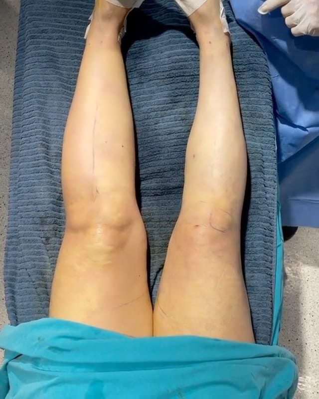 Post 9 by Dr. Hüseyin Güner Klinik on Instagram (carousel)