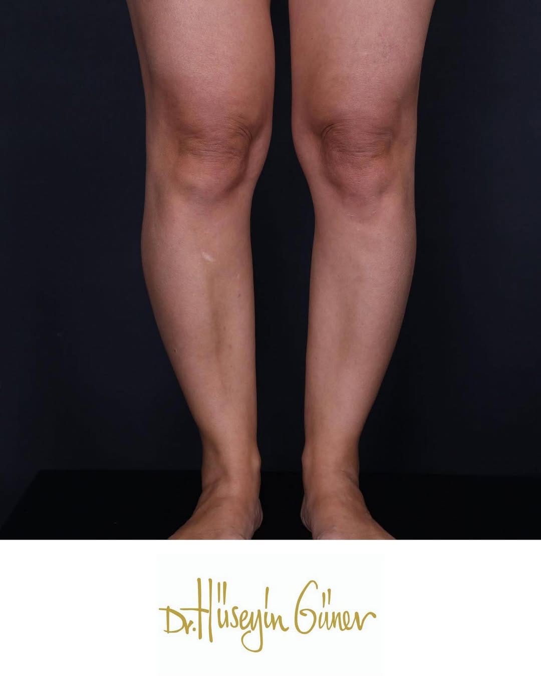 Post 3 by Dr. Hüseyin Güner Klinik on Instagram (carousel)