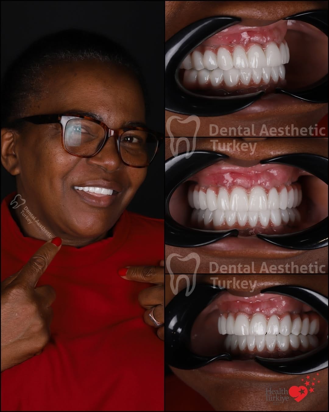 Post 2 by Dental Aesthetic Turkey on Instagram (carousel)