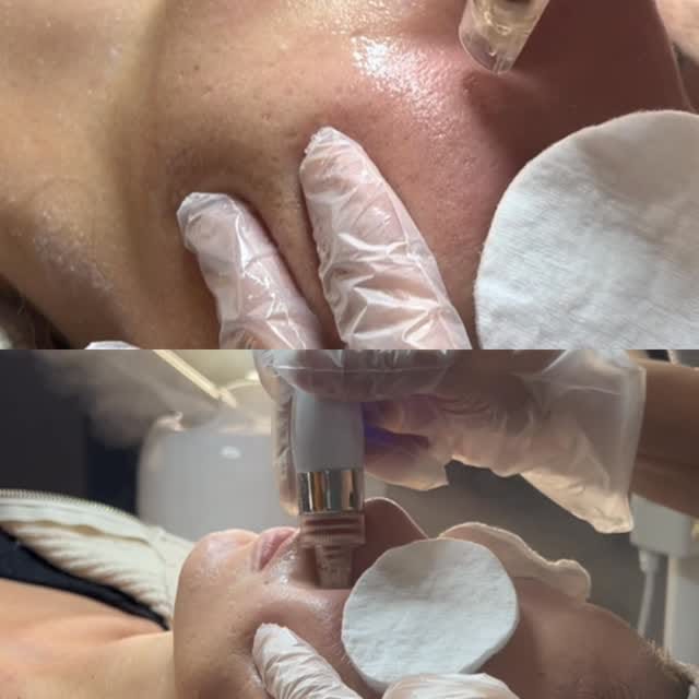 Post 9 by Aydan Gümüş Estetik ve Güzellik Salonu on Instagram (video)