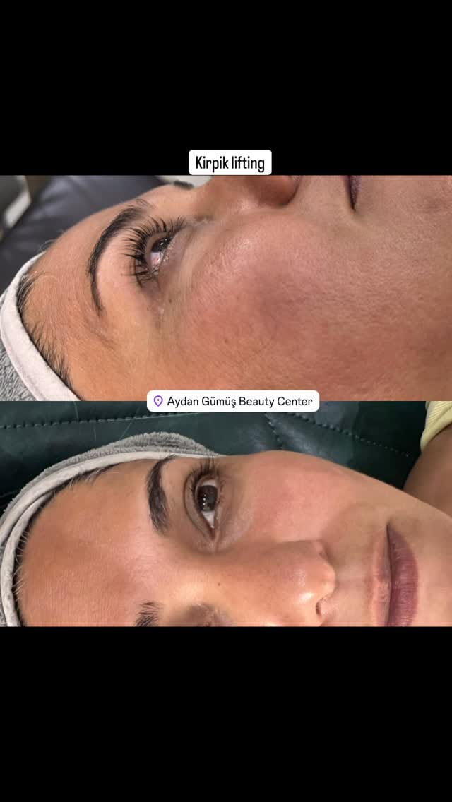Post 6 by Aydan Gümüş Estetik ve Güzellik Salonu on Instagram (video)