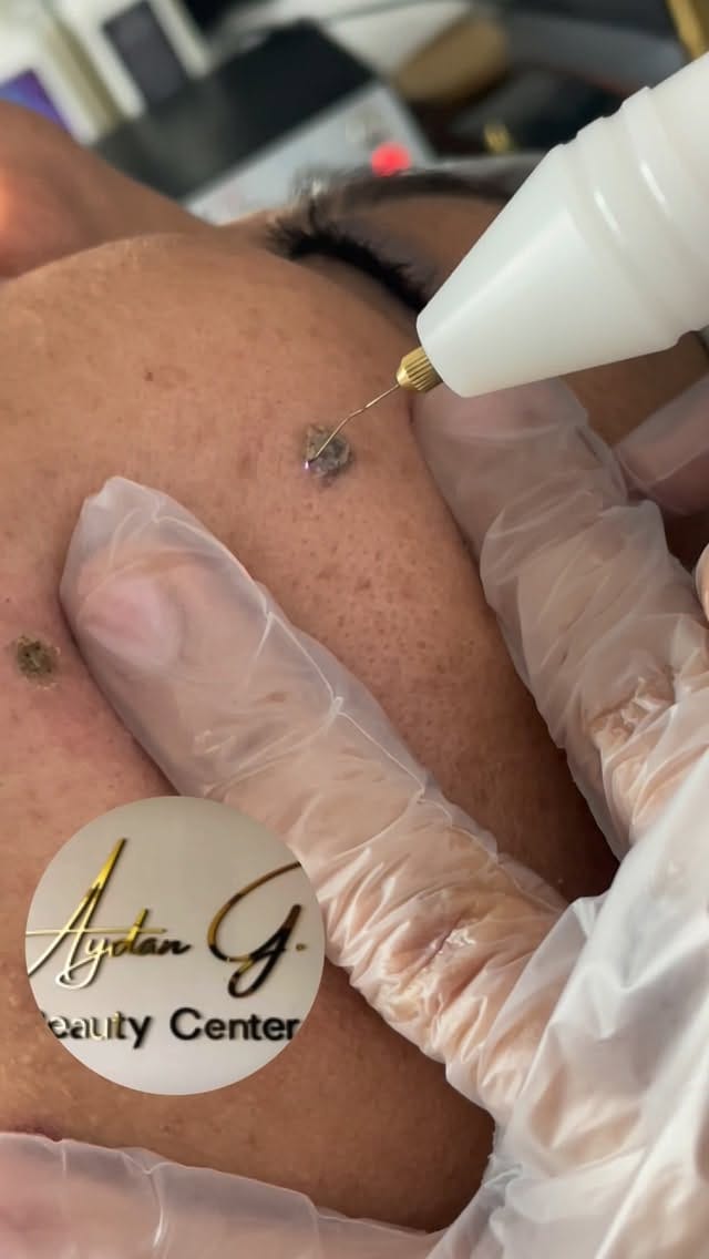 Post 1 by Aydan Gümüş Estetik ve Güzellik Salonu on Instagram (video)