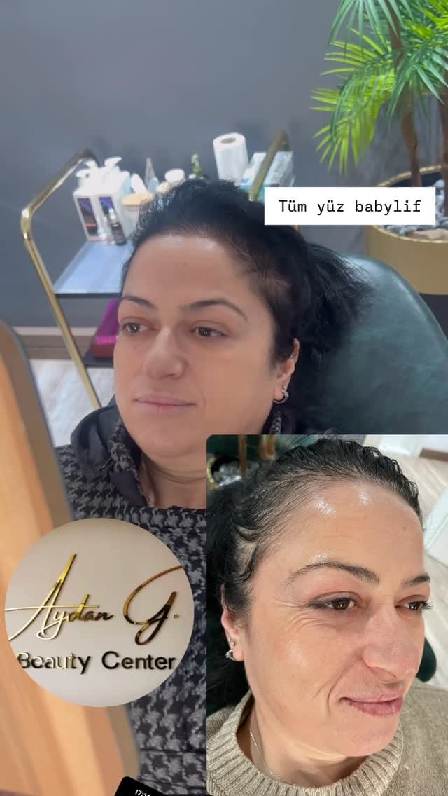 Post 2 by Aydan Gümüş Estetik ve Güzellik Salonu on Instagram (video)