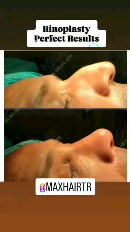 Post 4 by Max Hair Trans on Instagram (video)