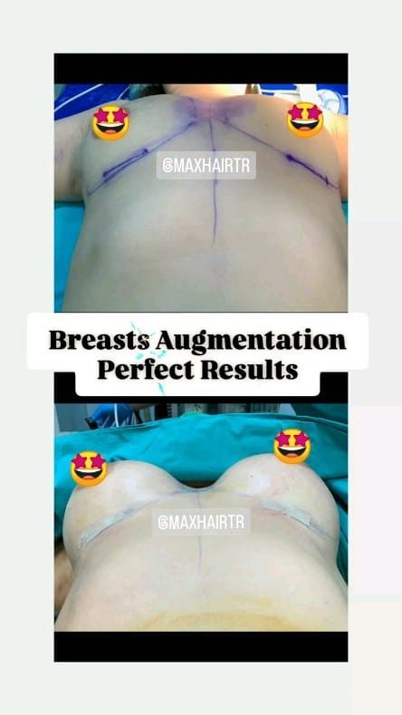 Post 3 by Max Hair Trans on Instagram (video)