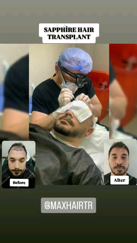 Post 6 by Max Hair Trans on Instagram (video)