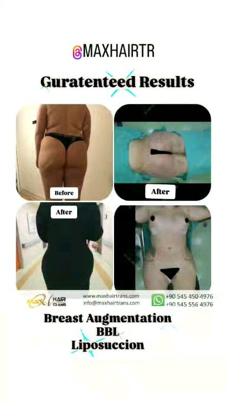 Post 7 by Max Hair Trans on Instagram (video)