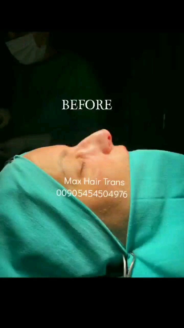 Post 8 by Max Hair Trans on Instagram (video)