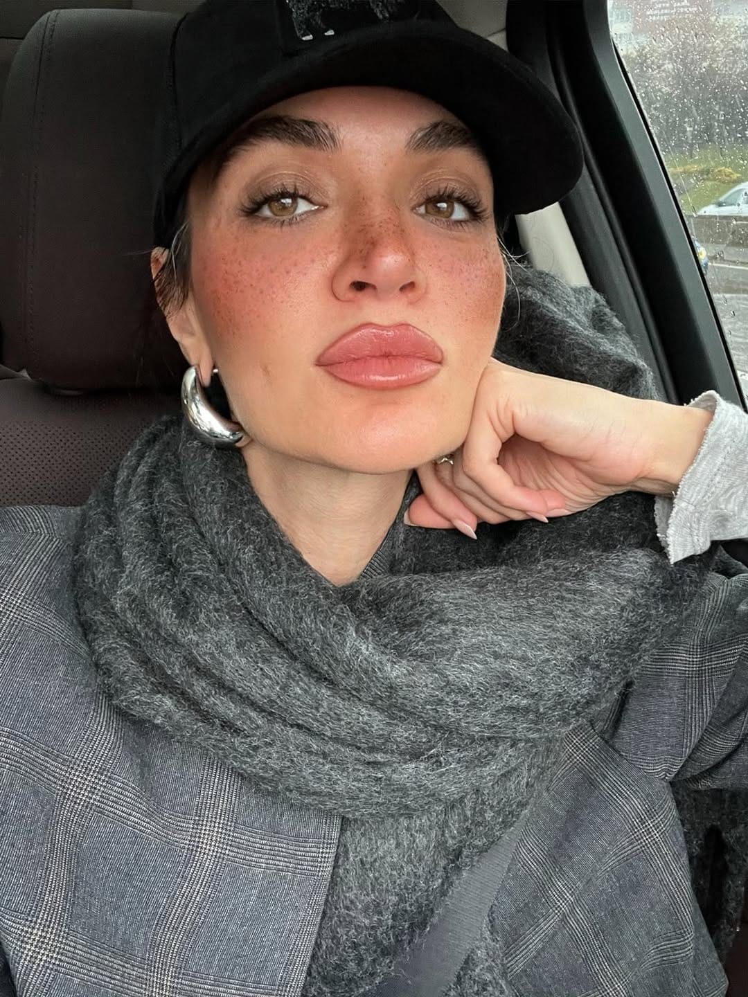 Post 1 by Gamze Tekin Alp on Instagram (image)