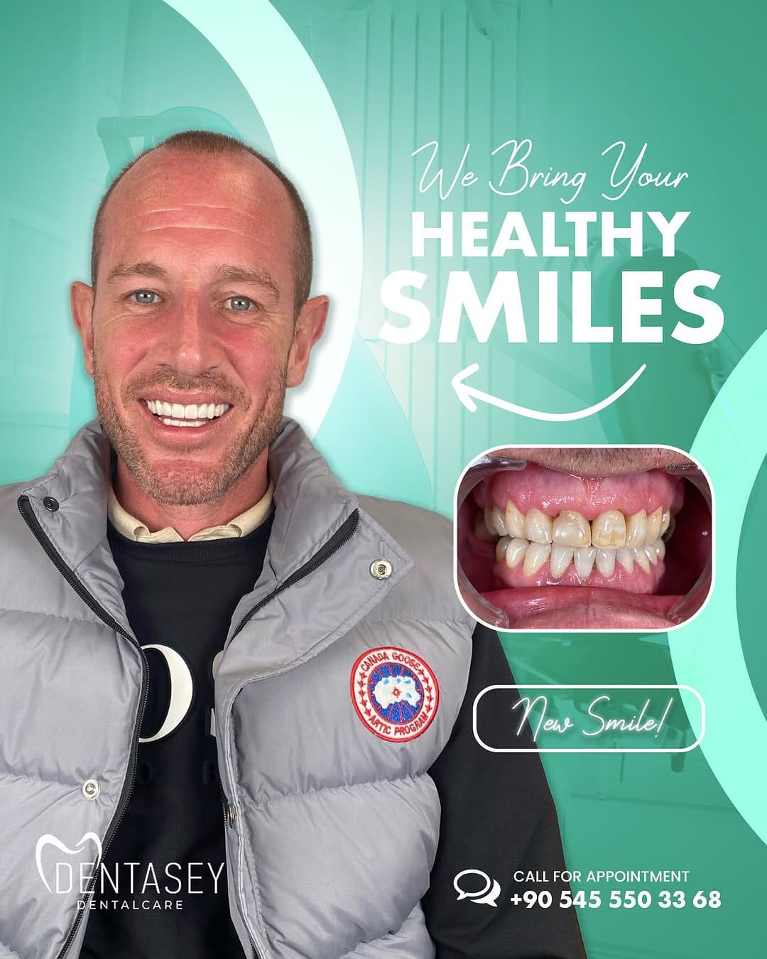 Post 10 by Dentasey Dental Care Kusadasi on Instagram (image)