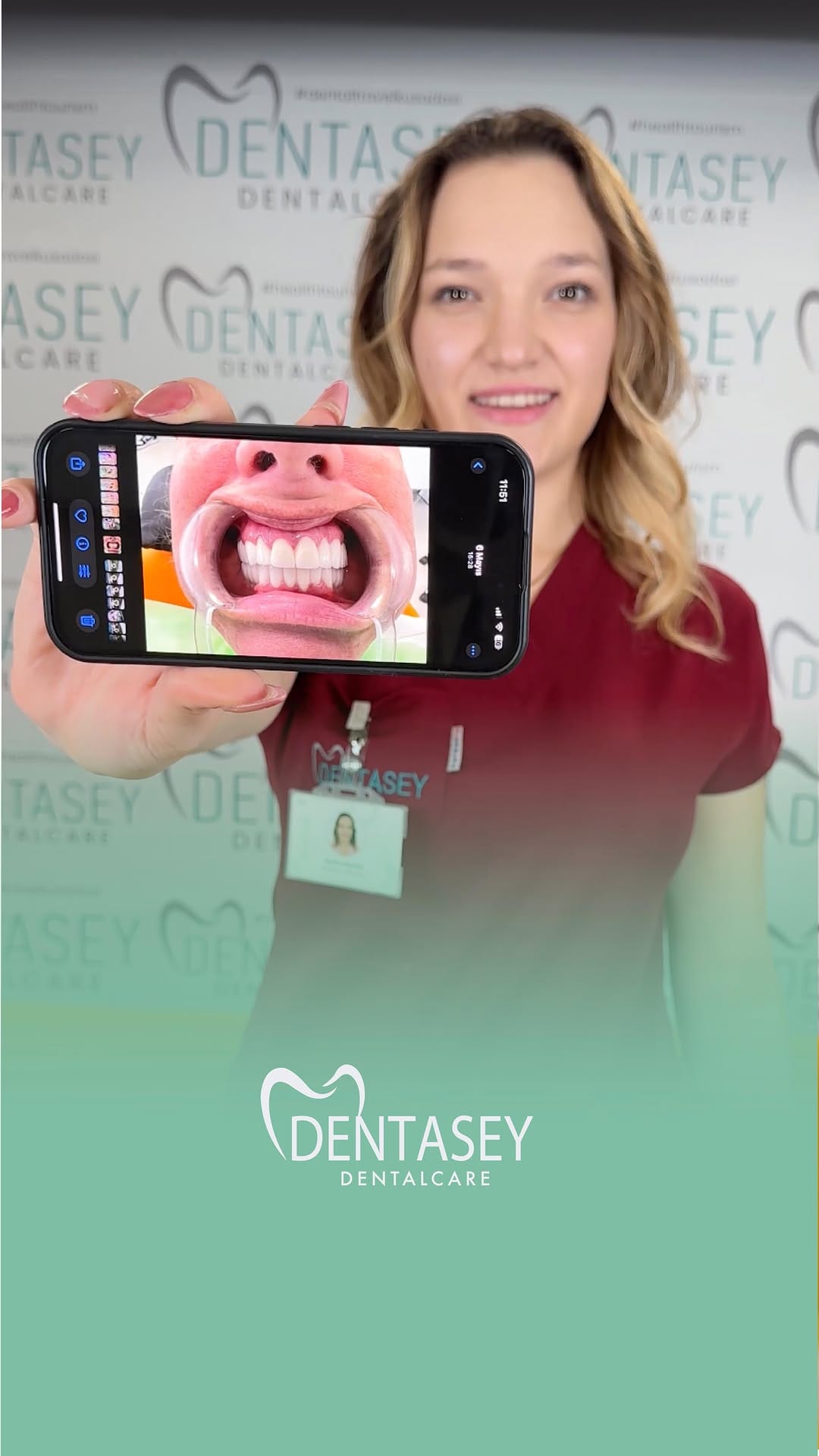 Post 8 by Dentasey Dental Care Kusadasi on Instagram (video)