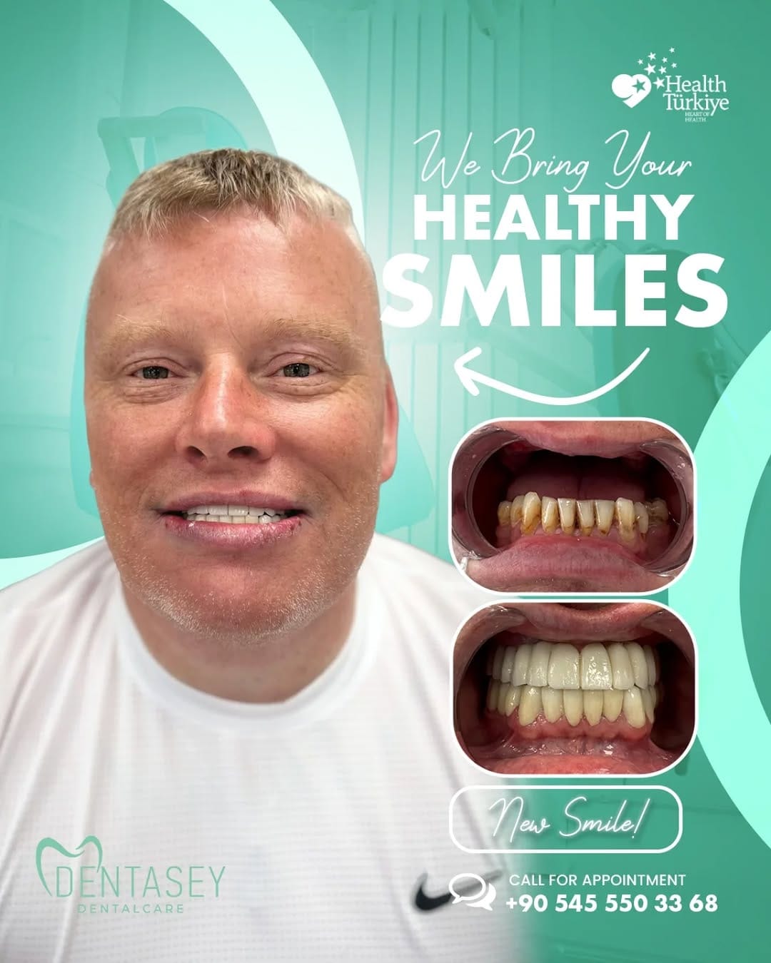 Post 2 by Dentasey Dental Care Kusadasi on Instagram (image)