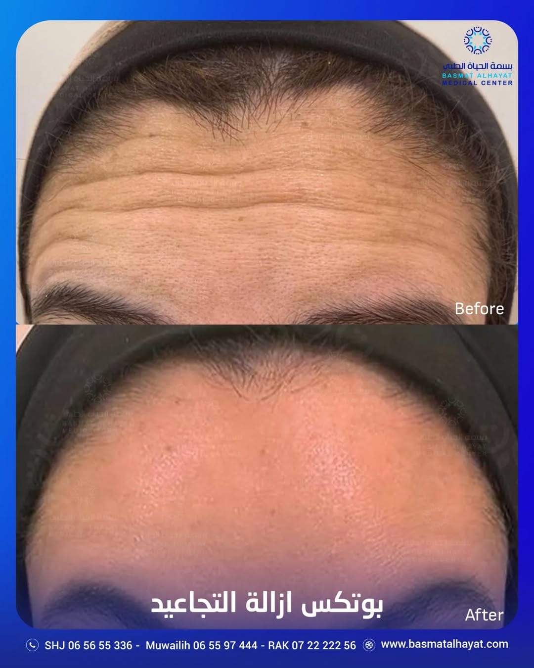 Post 3 by Basmat Alhayat Medical Center مركز بسمة الحياة الطبي on Instagram (image)