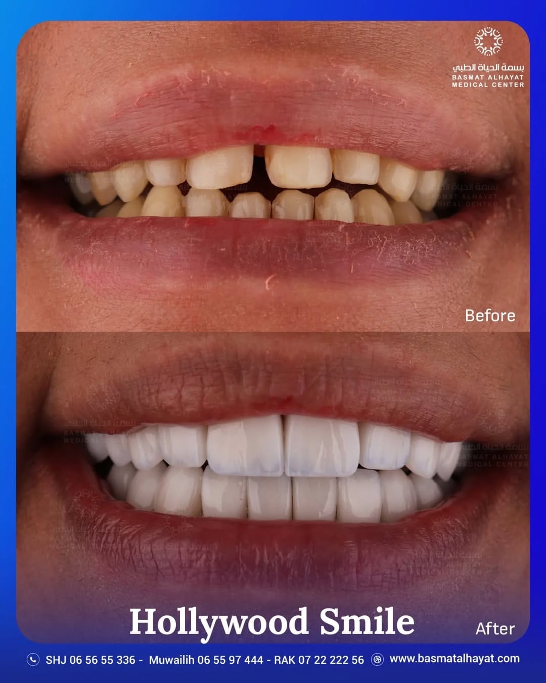 Post 6 by Basmat Alhayat Medical Center مركز بسمة الحياة الطبي on Instagram (image)