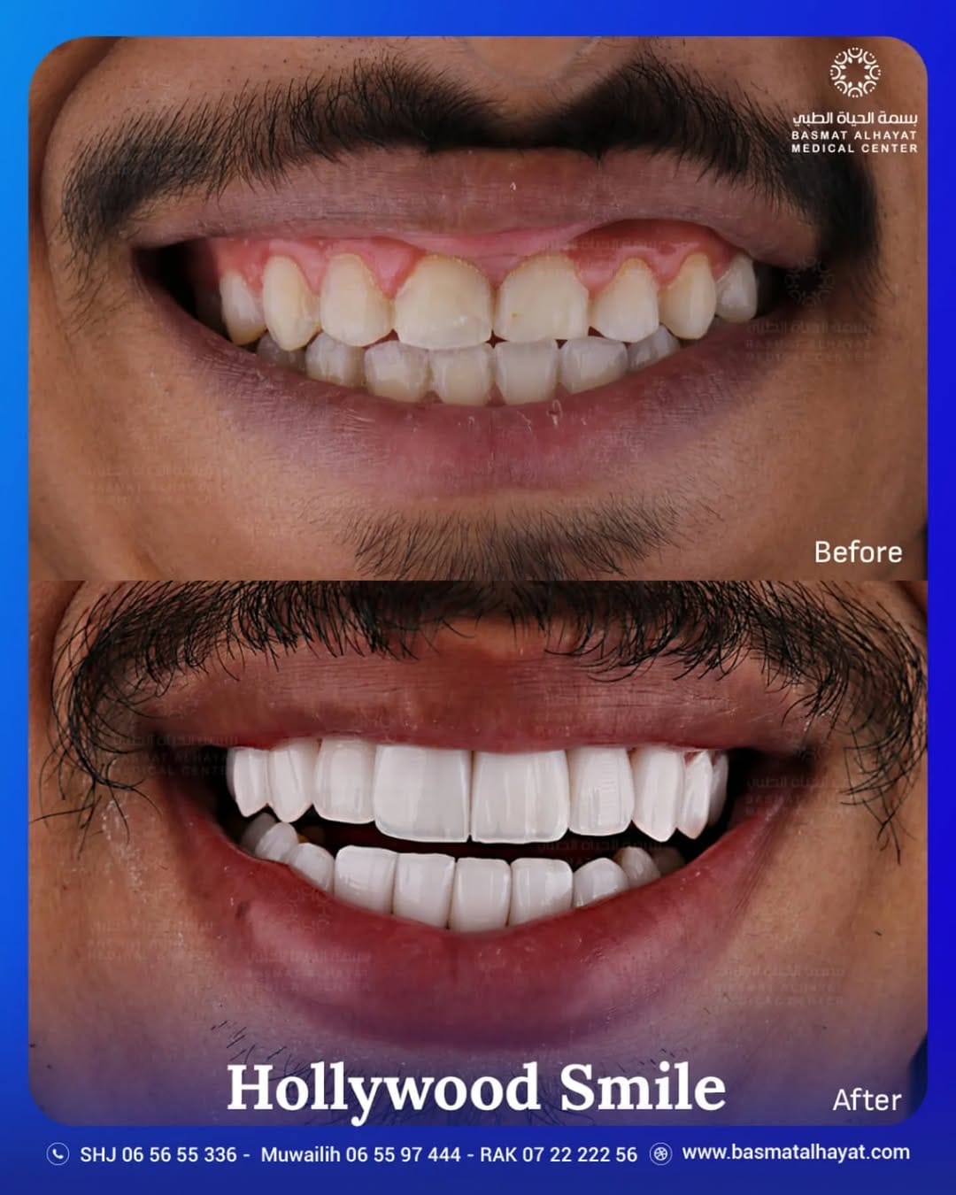 Post 9 by Basmat Alhayat Medical Center مركز بسمة الحياة الطبي on Instagram (image)