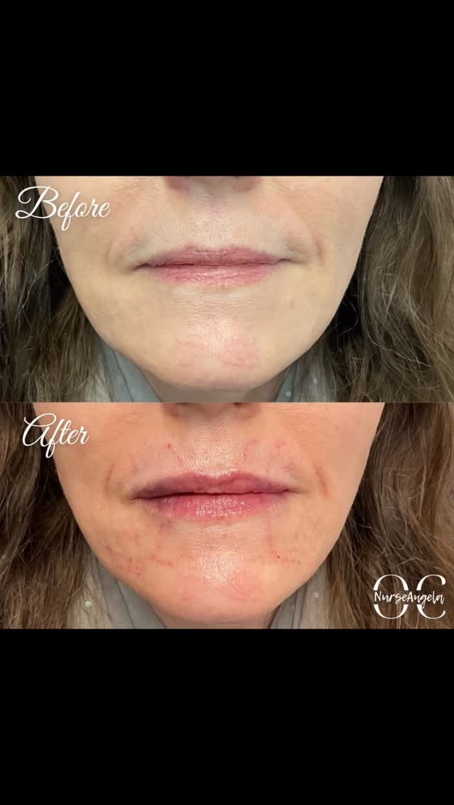 Post 7 by 𝓐𝓷𝓰𝓮𝓵𝓪 𝓣𝓪𝓹𝓲𝓪, 𝓡𝓝 on Instagram (video)