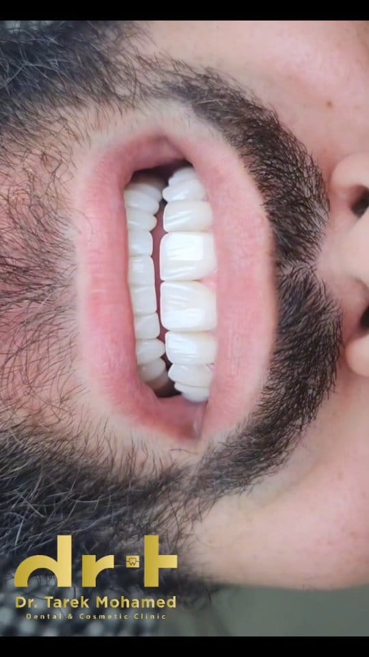 Post 1 by Dr. Tarek Mohamed on Instagram (video)