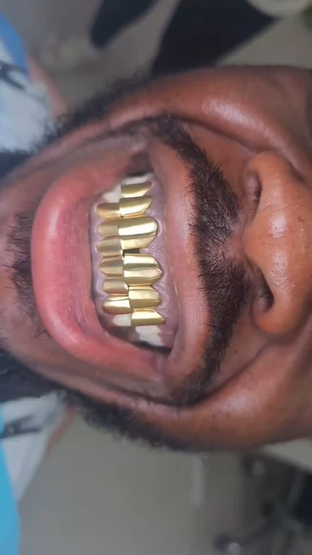 Post 8 by Dr. Tarek Mohamed on Instagram (video)