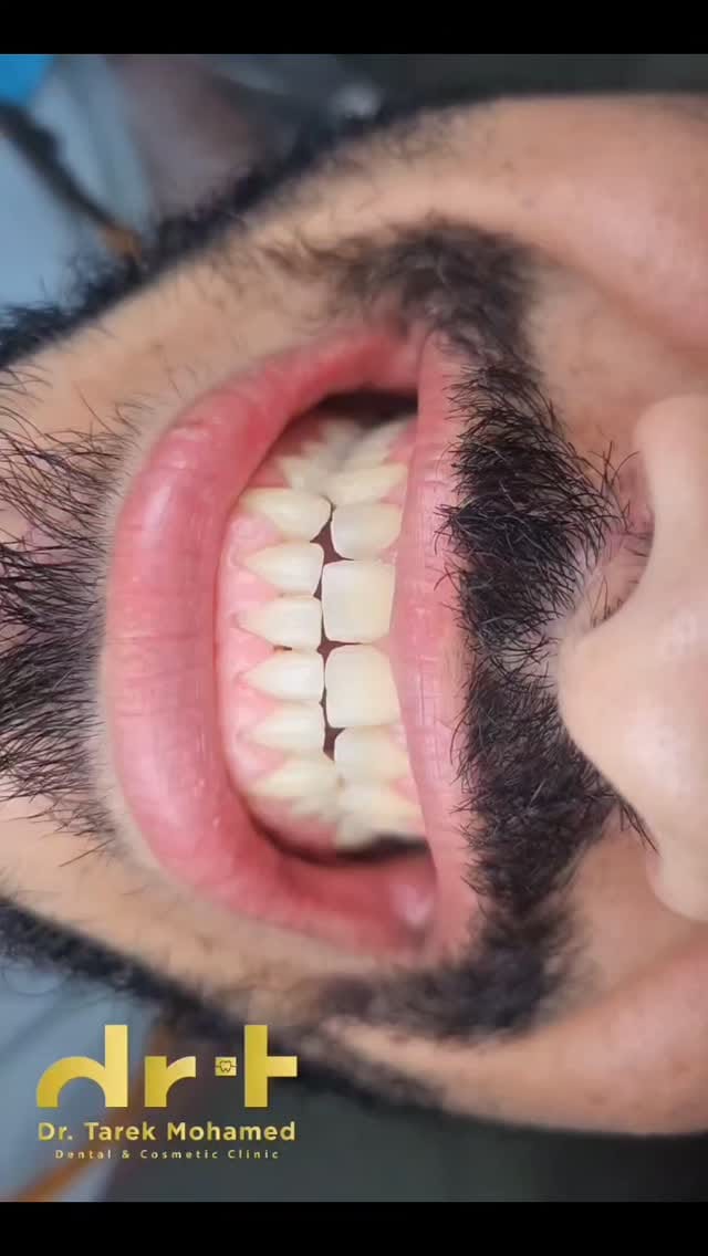 Post 3 by Dr. Tarek Mohamed on Instagram (video)