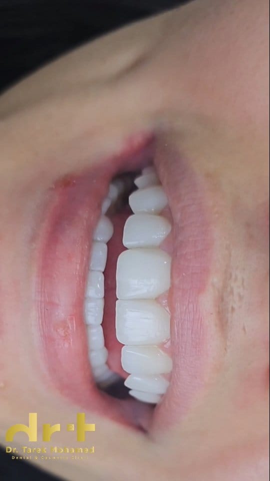 Post 4 by Dr. Tarek Mohamed on Instagram (video)