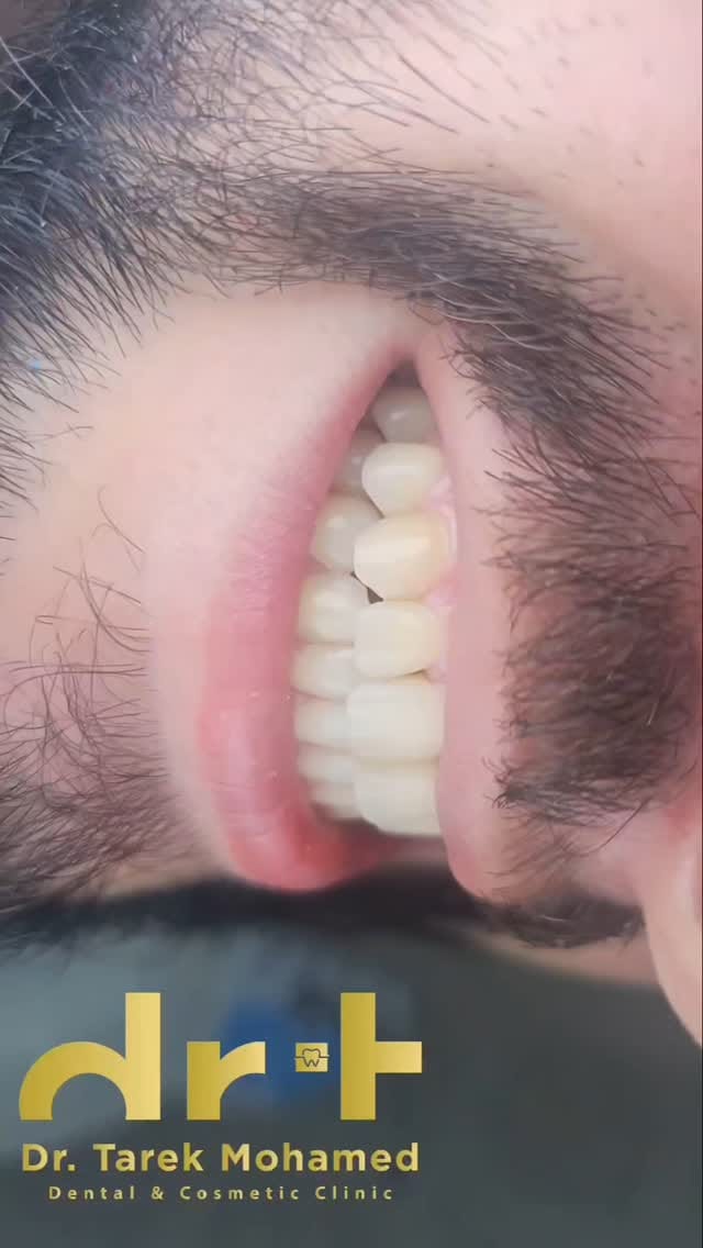 Post 6 by Dr. Tarek Mohamed on Instagram (video)