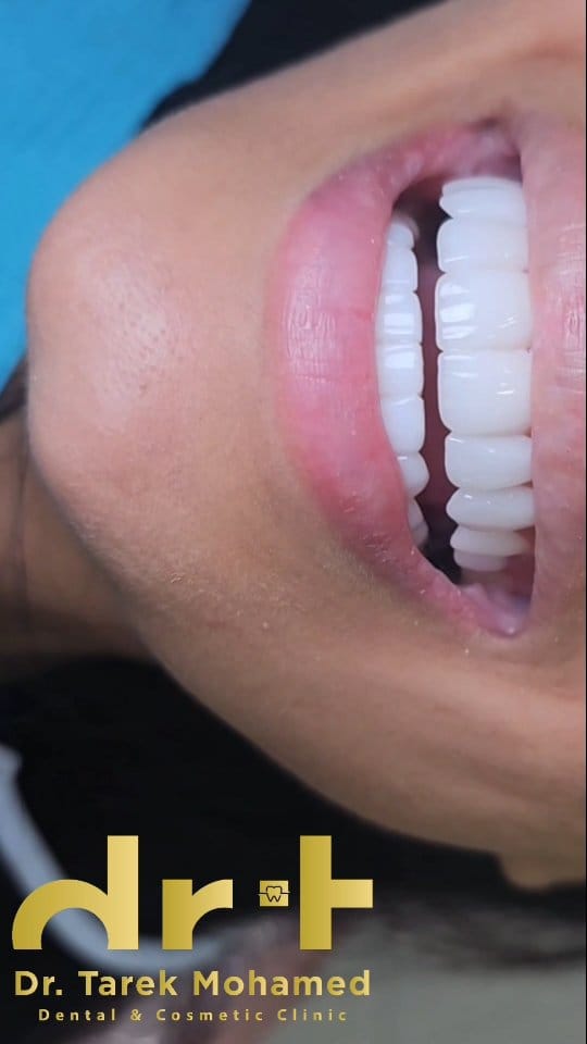 Post 5 by Dr. Tarek Mohamed on Instagram (video)