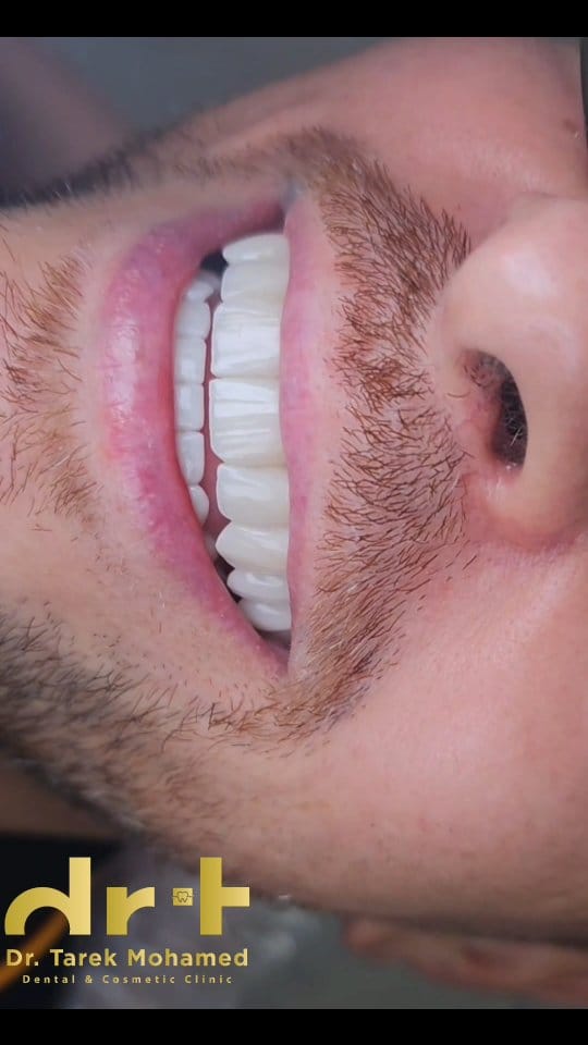 Post 2 by Dr. Tarek Mohamed on Instagram (video)