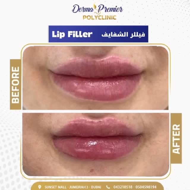 Post 8 by Dermapremier PolyClinic on Instagram (video)