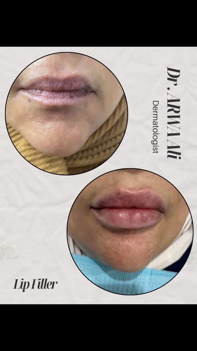 Post 8 by Dr Arwa Ali د اروى علي on Instagram (video)