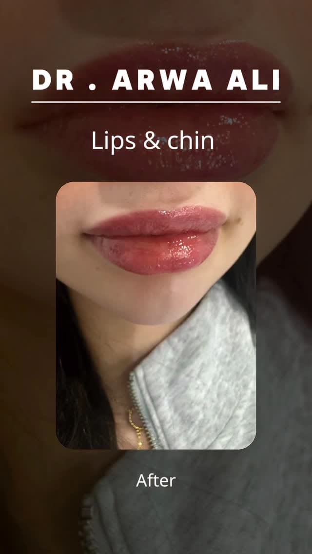 Post 7 by Dr Arwa Ali د اروى علي on Instagram (video)