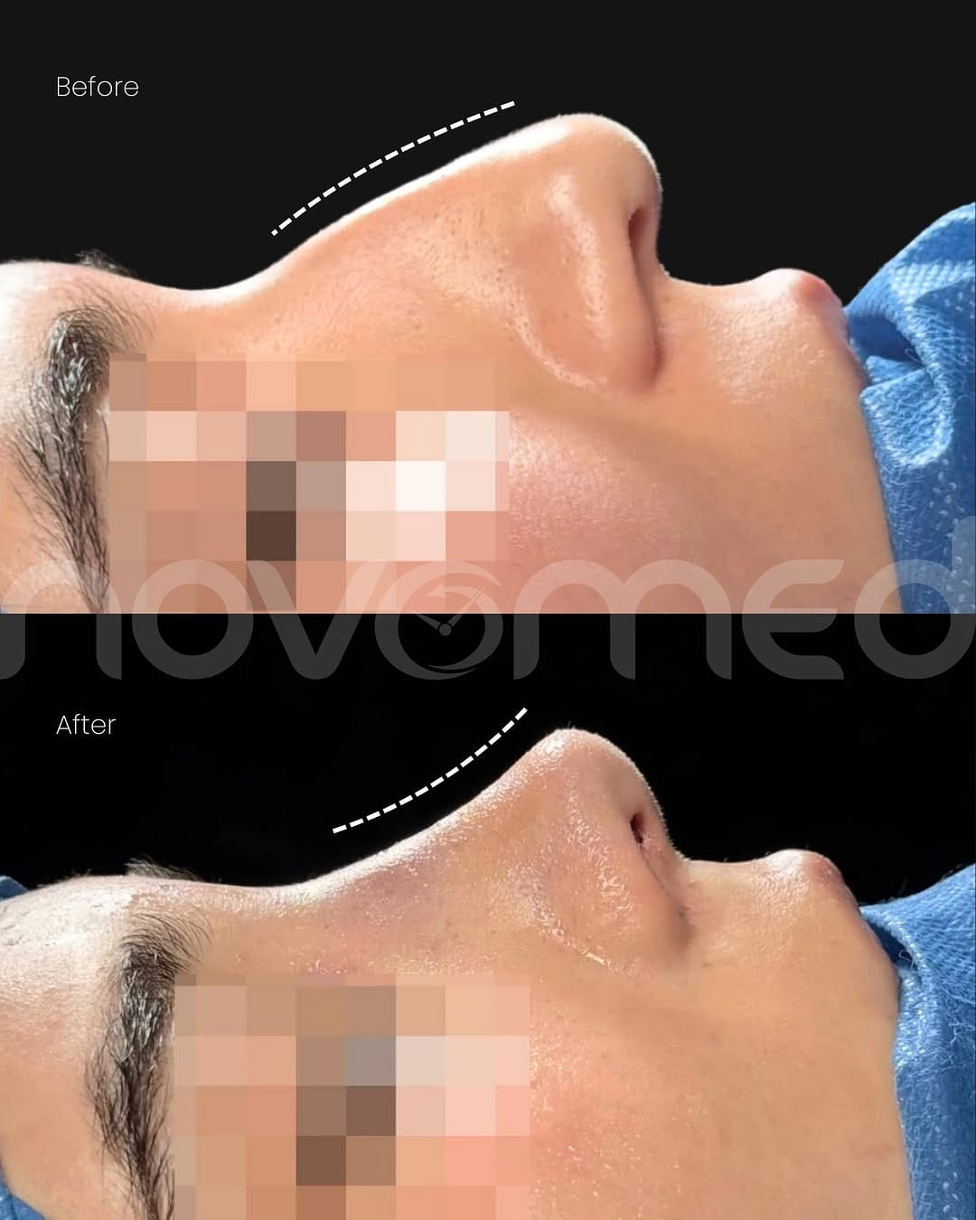 Post 2 by Novomed Centers & Hospitals on Instagram (image)