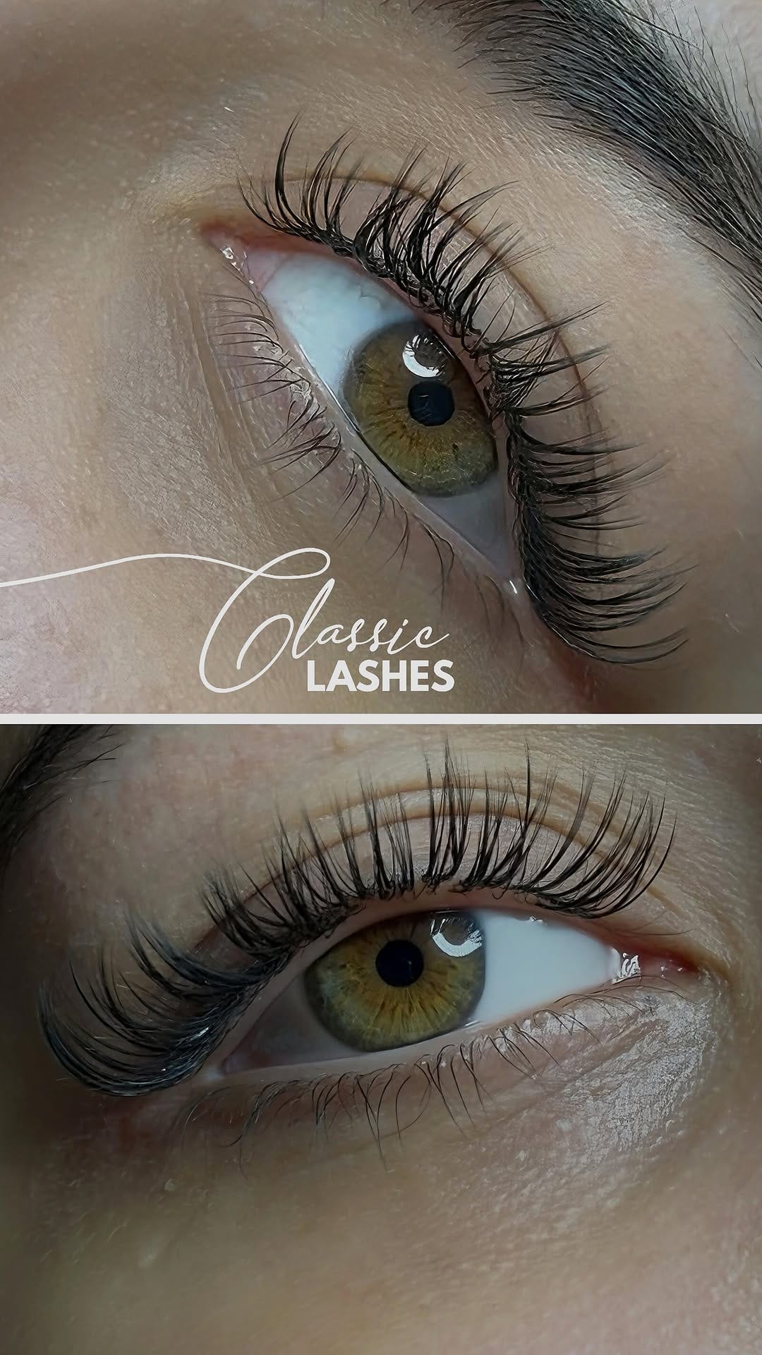 Post 1 by Beverly Hills Beauty Center on Instagram (video)